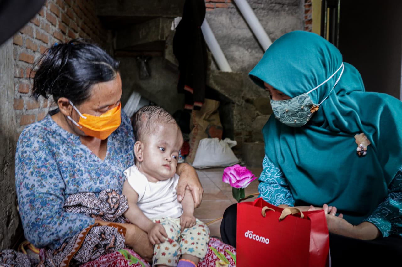 JENGUK ANAK PENDERITA HYDROCEPHALUS, INI YANG DILAKUKAN KETUA TP. PKK NTB